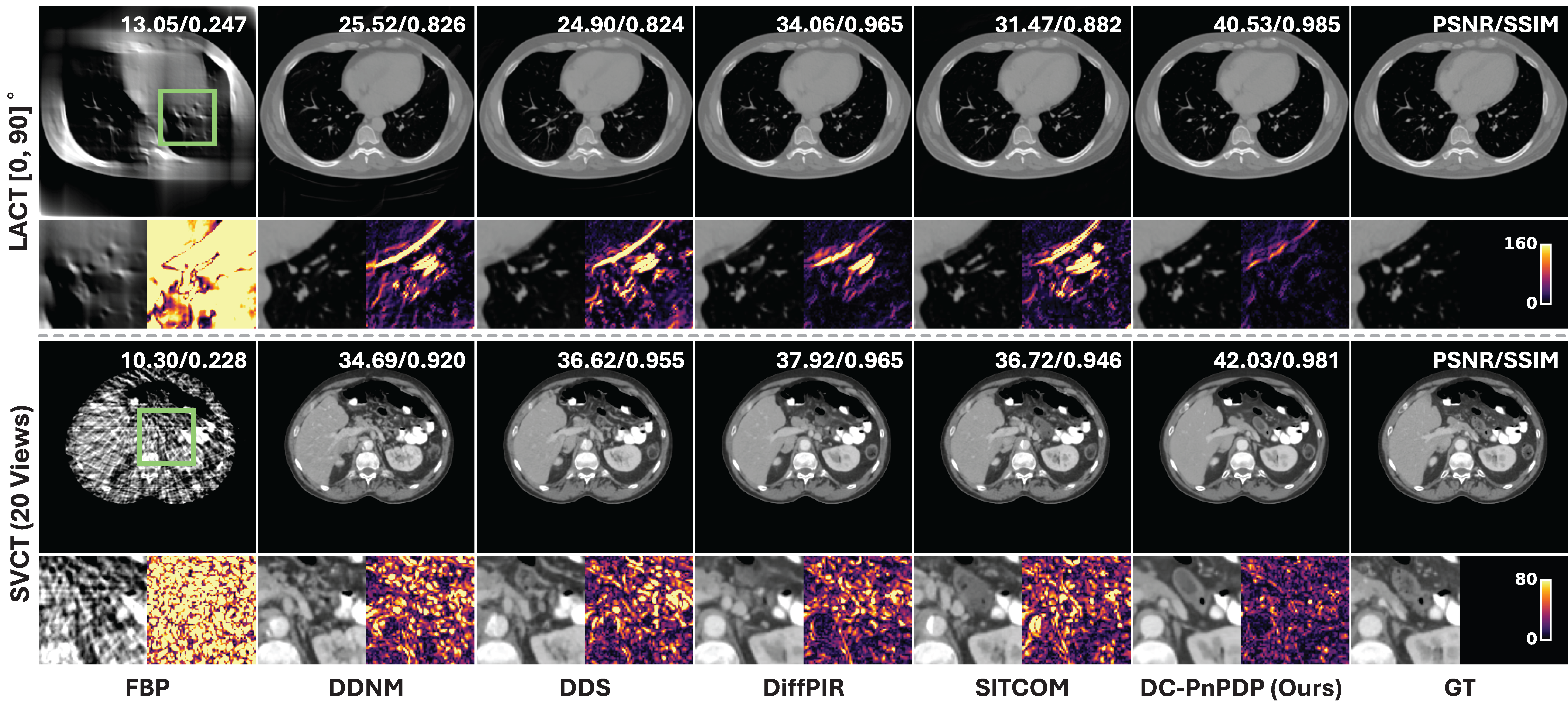 Qualitative CT reconstruction comparison