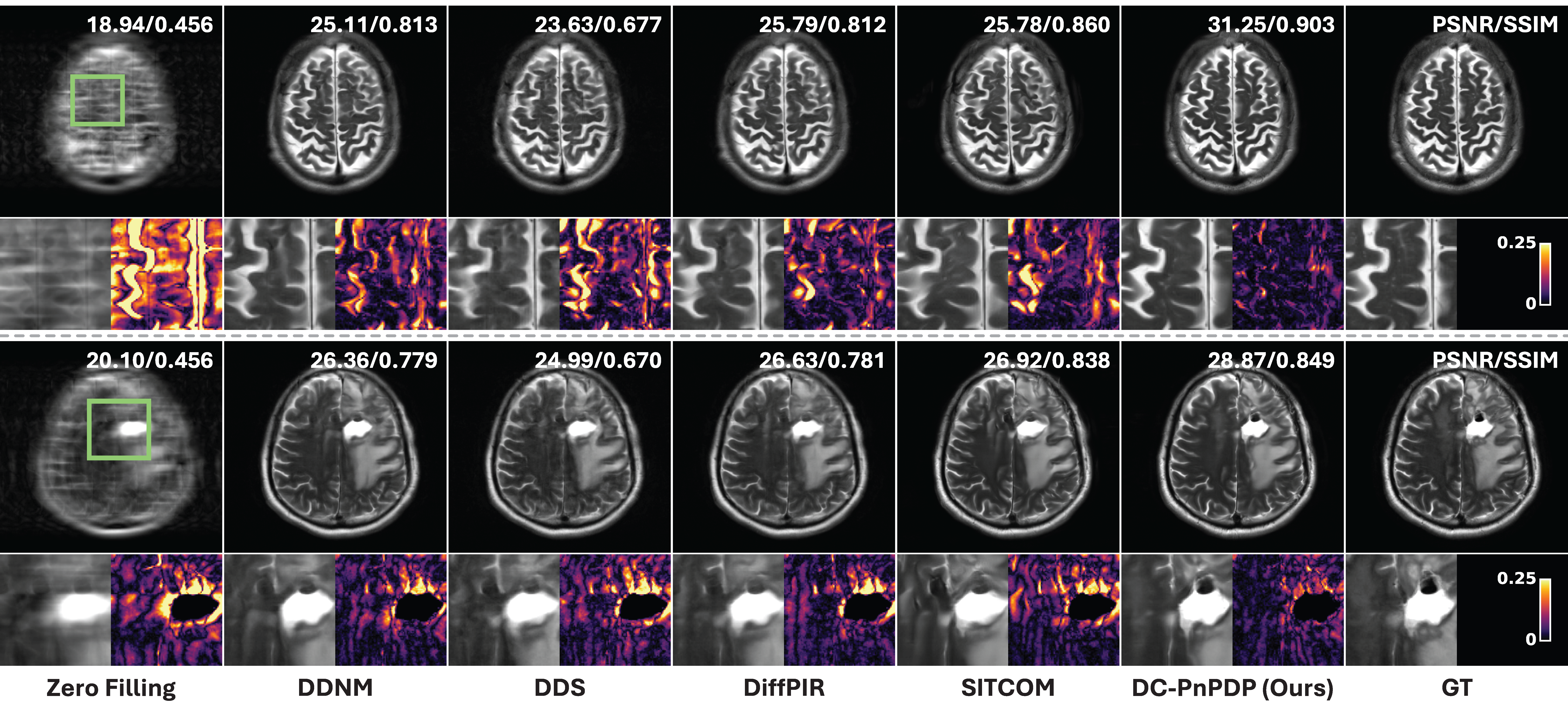 Qualitative MRI reconstruction comparison